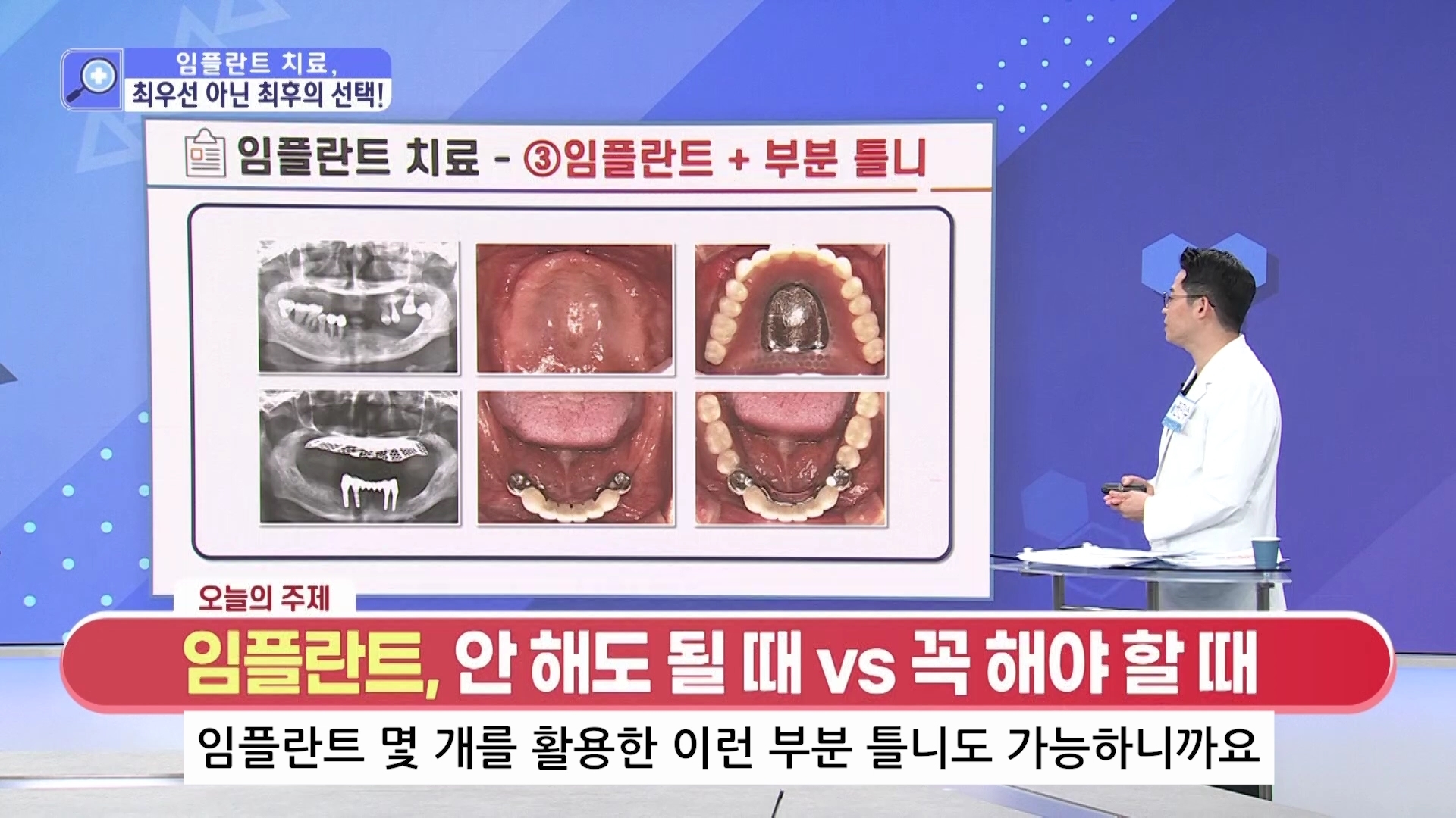 건강매거진_1부(권민수원장님) 05