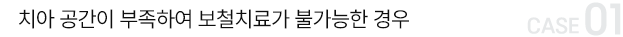치아 공간이 부족하여 보철치료가 불가능한 경우